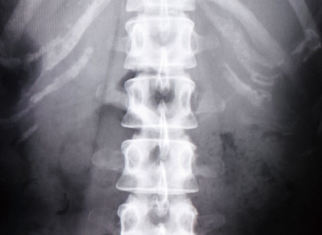 脊椎•脊髄外科